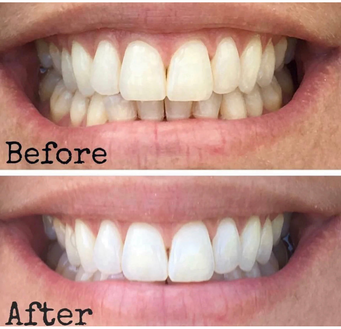 AP24 Whitening Toothpaste